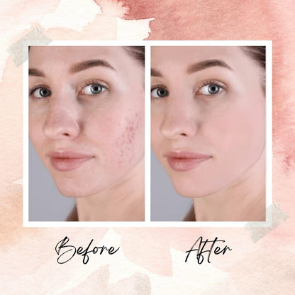 KOREANS™ PDRN Collagen Multi Balm