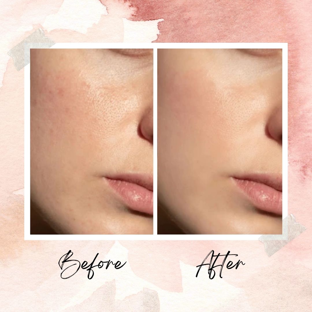 KOREANS™ PDRN Collagen Multi Balm
